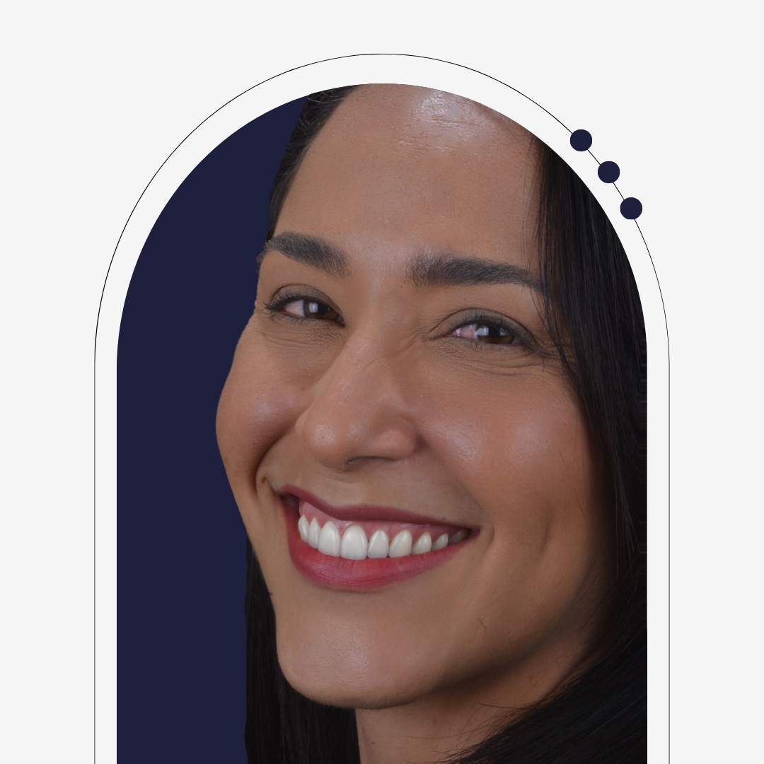 Sorriso de paciente após tratamento com Invisalign em Recife